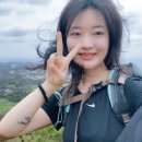 바이온드 | 잠실성형외과 이중턱지방흡입 후기 붓기, 바이오본드, 멍, 흉터 솔직 후기