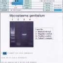 만성 전립선염이 잘 치료되는 자료-항생제 치료도 잘되고 ... 이미지