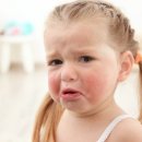 알레르기 이미지