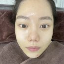 이마트에브리데이 매탄동점 | 수원매탄동피부관리 미다온뷰티 하이푸리프팅 후기:)