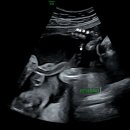 삼성미즈 앞 이미지