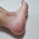 하경약국 | 풋케어 필수템 겨울 필수템 보습 스틱 후기