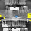 바른치과기공소 이미지