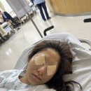 보이다 안경 | [성인사시 수술기] 네번째 이야기_수술 후기