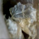 금천독일맑은보청기 이미지