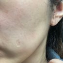 (주)케어이즈 | 피부 장벽 크림 피부과 연고로 유명한 닥터 PPS 하루종일 실크같은 피부