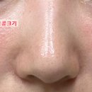 예손피부 이미지