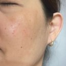 애프터아워스 | 매스티나 기미앰플 기미미백 매스틱 식스 아워스 앰플 플러스