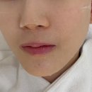 아이올라 | 중랑구피부관리 아이올라 망우점 전후 차이 솔직 후기