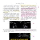 AV valvular disese질병을 가진 환자에서 PAP와 PVR을 변화시킬 수 있는 독립적인 요인과 그 결과값에 대한 해석 이미지