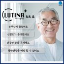 안경나라송정점 네이버블로그