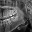 사랑니톡앤턱치과의원 이미지