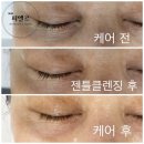 피엘르
