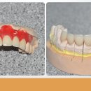 이천치과기공소 이미지