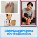 류마통내과의원 | 통풍 발 통증이 지속된다면 대사 질환 여부를 확인해 보세요