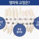 이·스마일치과교정과치과의원 이미지