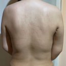 바디힐링근육풀이 | 영등포 바디관리 고주파+미세전류 바디관리 후기 퀸힐링테라피