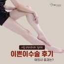 서울 논현산부인과 질성형 이쁜이수술 후기 여의사 효과는?