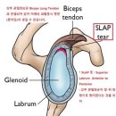 SLAP op 이미지
