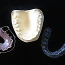 서강의원 | 아이스크림 먹을 때마다 찌릿! 평택 앞니 충치 치료 솔직 후기