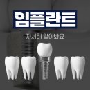 감동e플란트치과의원 이미지