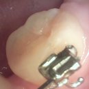 더연세퍼스트치과병원 이미지