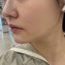 비엘2 | 천안 에스테틱 두정동 비엘뷰티에서 온다리프팅 땡기고 온 솔직 후기
