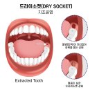 장신경과의원 | 사랑니 발치, 알고 서창동치과 가면 덜 무섭습니다