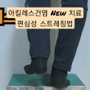 아키레스건염 치료 이미지