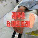 레푸스&아트포레 | 부산 무좀발톱 해운대 발각질 스케일링으로 깨끗하게 당당해지는 발관리