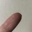 이솜치과의원 | 차니지일상_ 이천 갈산동 이솜치과 / 발치 / 임플란트 / 뼈이식/ 이솜치과 방문 및 임플란트 수술 후기