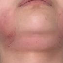 쁨글로벌의원 이미지