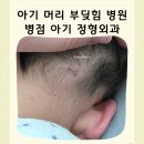 명신치과의원 | 아기 머리 부딪힘 병점 아기 정형외과