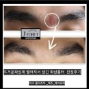 제이포레시피 | 얼굴 미간 왁싱화상도 말끔히 진정케어로 관리후기 [제주/제이포레에스테틱]