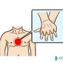 심폐소생술방법 순서 사람을 살리는 응급 처지 가이드! 이미지