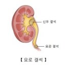 요로결석!!! 제가응급실로 간까닭은??? ㅠㅠㅠ 시금치 ,멸치 ,칼슘너무먹지 말라네요!!! 이미지