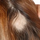 비엔엘에스테틱아카데미 이미지