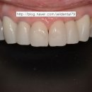 광안치과기공소 이미지