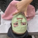 송한의원 | 강남 피부전문 한의원 엠톤 + 미세필링 효과는? 여드름 자국 개선 과정 2회차 기록