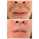 합성동369 | 창원왁싱 창원인중왁싱 &amp; 창원턱왁싱 잘하는👍 창원슈가링왁싱전문🏅 창원금손언니왁싱🥰