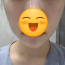 로이(Loy) 에스테틱 | 마포피부관리 잘하는곳 모공스케일링 후기 로이에스테틱 마포본점