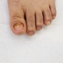 고봉로 28길 네이버블로그
