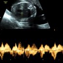 반전 | 정밀초음파 시기 얼굴 비용 소요시간 성별반전 후기