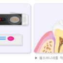 우리부부치과 네이버블로그
