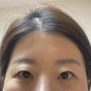 지윤헤어라인