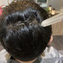 제트피바이오 | [분당두피케어] 나의 두피 절대지켜! 탑스칼프 분당점~★ 절대 지켜 소중한 머리!