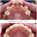 OK치과기공소 이미지