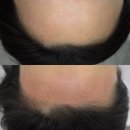 모나리자헤어 | 일상왁싱 마두역 모나리자 눈썹 왁싱 헤어라인왁싱 후기