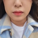 공감백치과의원 | [일상] 미루고 미뤄왔던 사랑니 뺀 후기