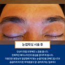 그남자왁싱 이미지